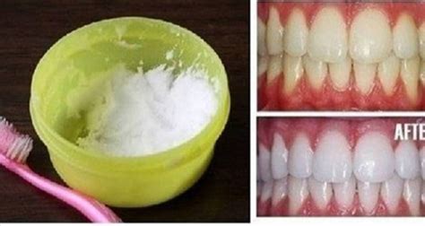 How To Have White Teeth At Home In Just 3 Minutes