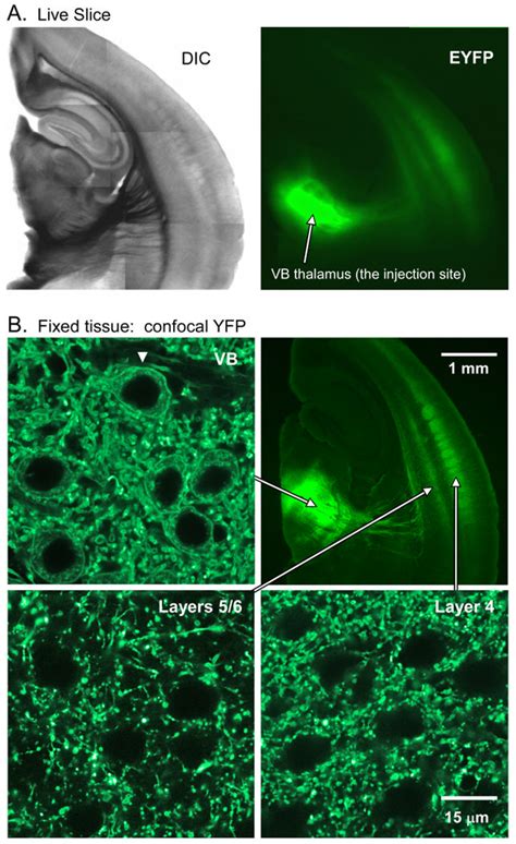 Lentivirus Injections Into Thalamus Produced ChR2 EYFP Expression In TC