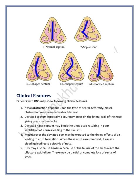 Dns (Deviated Nasal Septum) | SurgicoMed.com