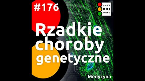 Rzadkie Choroby Genetyczne Youtube