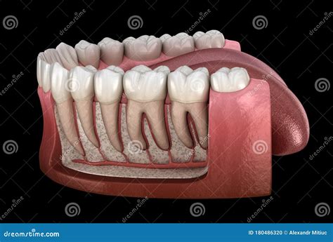 Anatomía De La Raíz Dental De La Visión De La Goma Humana Mandibular Y ...