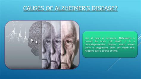 Ppt Alzheimers Disease Causes Symptoms Treatment Powerpoint