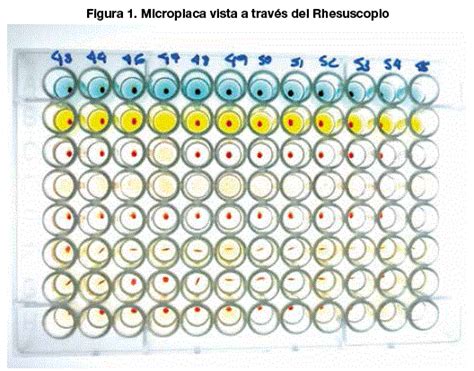 Frecuencia de grupos sanguíneos ABO y RhD en universitarios de El Alto