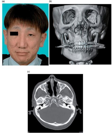 post operative view   ct image  axial ct image    year