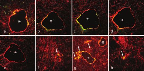 A Subset Of Thymic Epithelial Cells Preferentially Express Respiratory