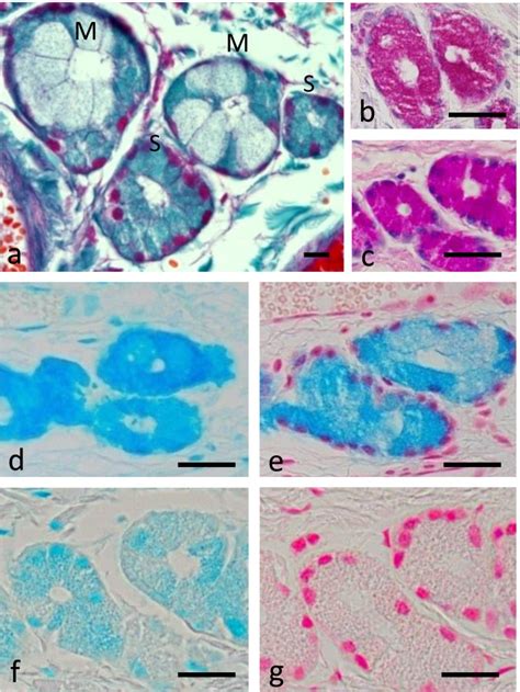 Histological Features Of The Serous And Mixed Glands Within The Lamina