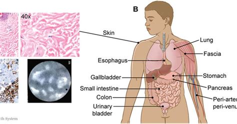 Interstitium: Scientists say they've discovered a new human organ