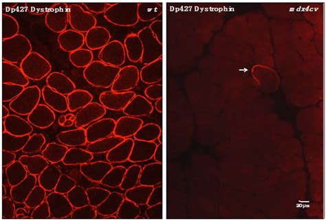 Immunofluorescence Microscopical Localization Of Dystrophin Isoform