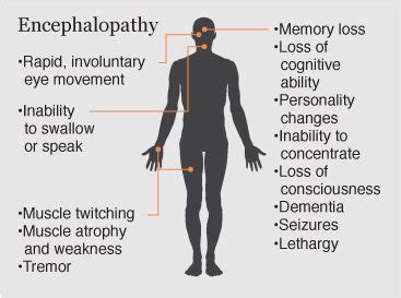 Encephalitis Symptoms