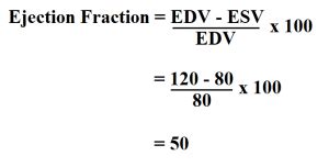 How to Calculate Ejection Fraction.