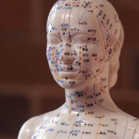 Acupuncture Vs Dry Needling Understanding The Differences And Benefits