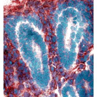 Mesenchymal expression of prostacyclin synthase in the developing human ...