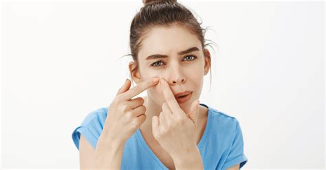 Understanding Blackheads A Comprehensive Guide