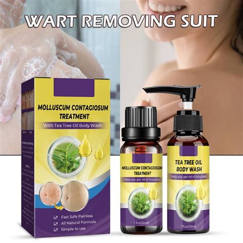 Molluscum Contagiosum Treatment Kit Solution And Tea Tree Oil Body Wash Shopee Malaysia