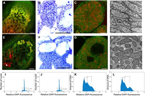 Figure From The C H Transcription Factor Regulator Of Symbiosome