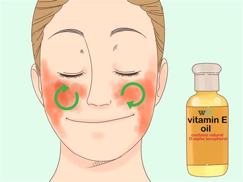 3 Ways to Treat Face Eczema - wikiHow