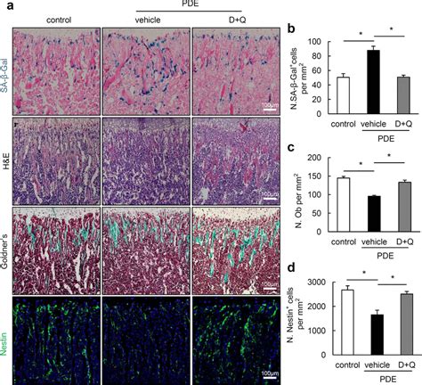 Clearance Of Senescent Cell By Treatment With Senolytics Dasatinib And