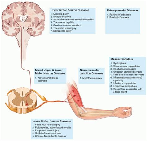 types of neuromuscular disease Neuromuscular diseases:, medical test ...