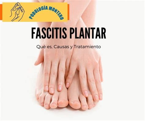 Fascitis plantar qué es cuáles son sus causas y qué podemos hacer