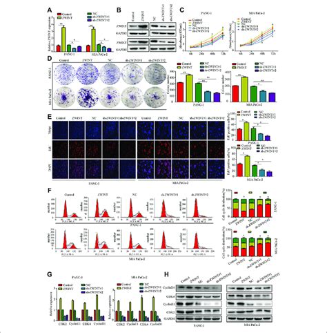 Zwint Enhances Pc Cell Proliferation Induces G S Phase Transition In