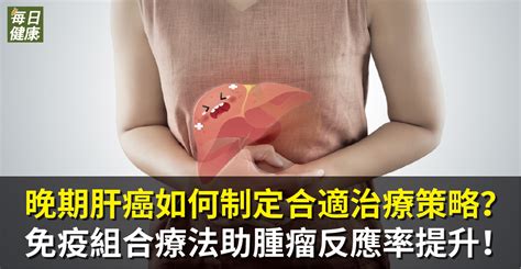 晚期肝癌如何制定合適治療策略？免疫組合療法助腫瘤反應率提升！ 健康 Nownews今日新聞