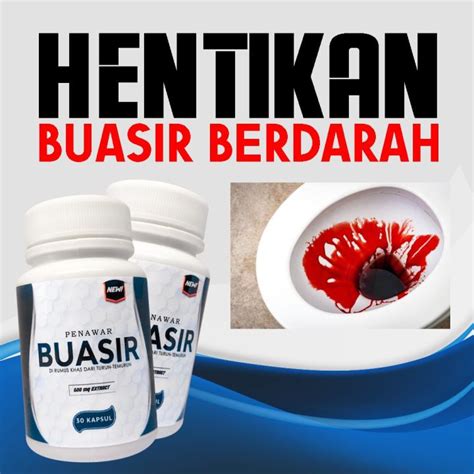 Penawar Buasir Ubat Buasir Paling Berkesan Mujarab Buasir Kecut Dalam