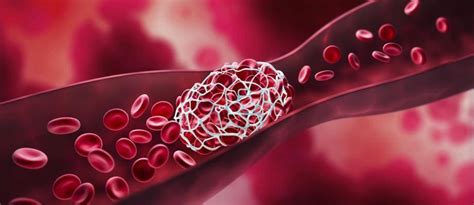 Blood Clotting Process: A Comprehensive Guide