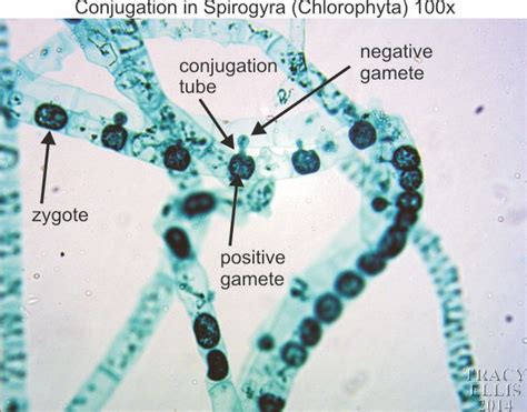 Spirogyra Under Microscope Labeled