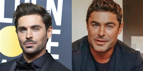 Zac Efron Addressed ‘Jaw-Gate’ Speculation That He Had Plastic Surgery | Your Esthetic Advisor