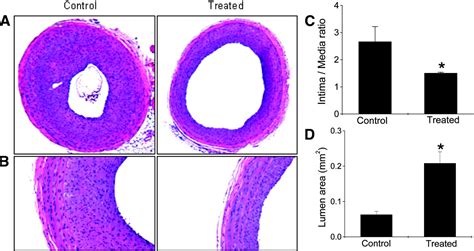 Inhibition Of Apoptosis Through Localized Delivery Of Rapamycin Loaded