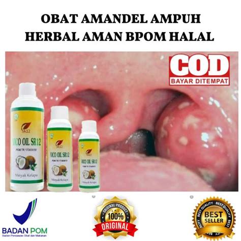 Obat Amandel Ampuh Herbal Obat Amandel Dewasa Dan Anak Obat