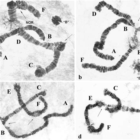 Salivary Gland Chromosome Ab Of Stictochironomus Sticticus A Active