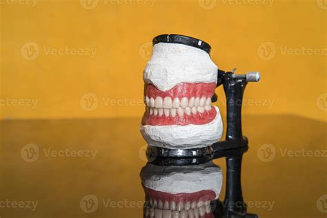 model of teeth for dentists to explain various tooth diseases or