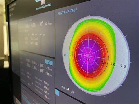 Is LASIK right for me? - Wills Laser Vision