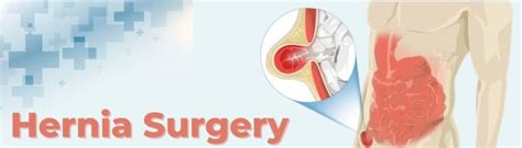 Hernia Specialist In Pune India Hernia Surgery Dr Samrat Jankar