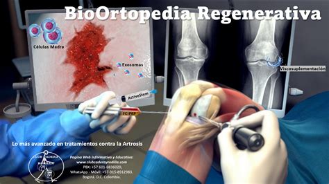 Club Cadera Y Rodilla Clinica De La Cadera Y La Rodilla Pagos