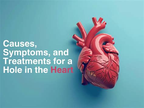 symptoms  treatments   hole   heart