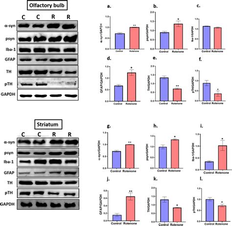 Effect Of Rotenone On Expression Of Different Protein Markers In OB And