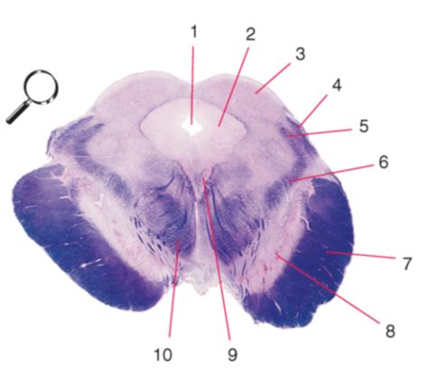 Brain Stem Cross Sections Flashcards Quizlet