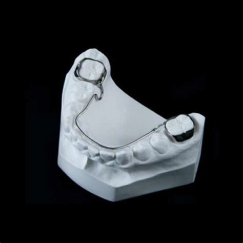 Maxillary Removable Bilateral Space Maintenance Nance Appliance