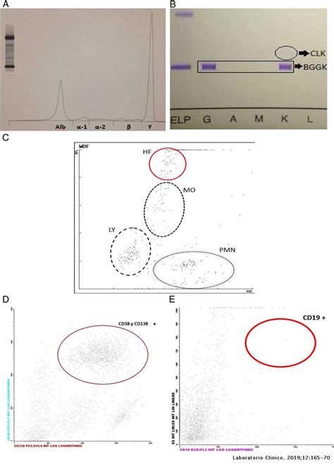 Papel Central Del Laboratorio En El Diagnóstico De Un Caso De