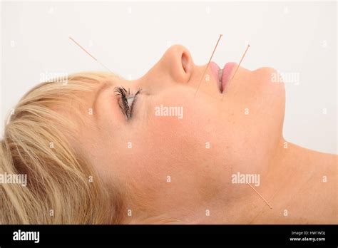 Acupuncture needles face hi-res stock photography and images - Alamy