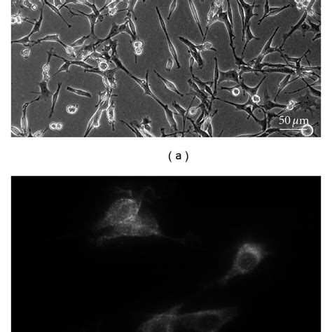 Ifrs1 Showed Distinct Schwann Cell Phenotypes Such As Spindle Shaped