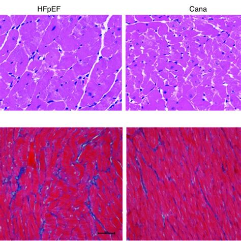 He Staining And Masson Staining Of Myocardial Tissue In Each Group A Download Scientific