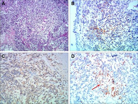 Histochemical And Immunohistochemical Examinations Of The Tumors From