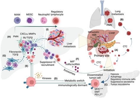 Metastatic Cascade During Pdac Progression A Cells Disseminating From