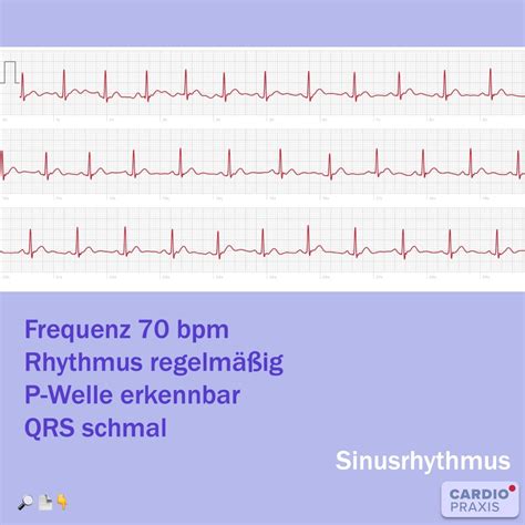 Gesundes Ekg Frau Deals Innoem Eng Psu Ac Th