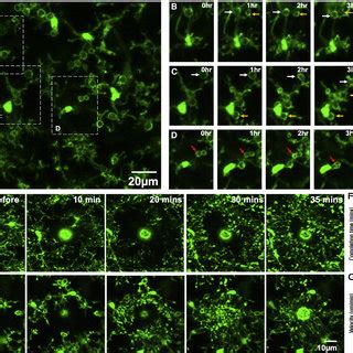 Severe Seizures Induce Microglial Process Pouch Formation A