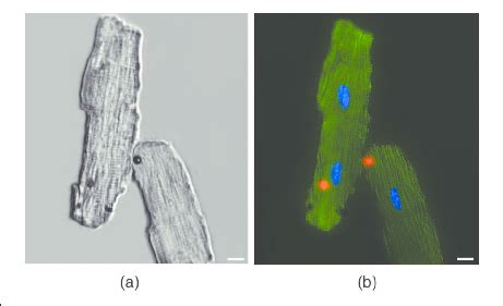 Adult Mouse Cardiomyocyte Imaged Using Bright Field And Fluorescence