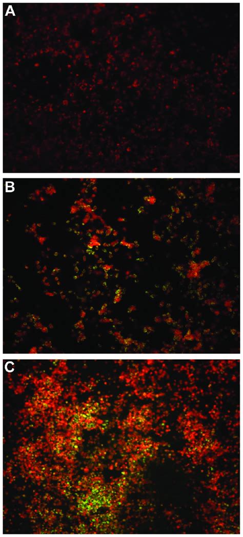 Detection Of Enterovirus Vp1 Protein By Immunofluorescence Staining In